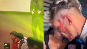 Ex Mekano quedó ensangrentado tras pelea con influencer en evento