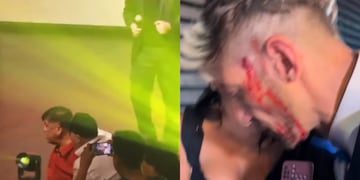 Ex Mekano quedó ensangrentado tras pelea con influencer en evento