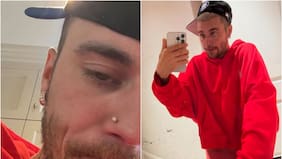 Comportamiento de Justin Bieber encendió las alarmas entre sus fans: “Que alguien lo meta a rehabilitación”