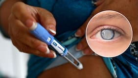 “Puedes despertar súbitamente ciego”: Alerta por el uso de Ozempic y fármacos para bajar de peso