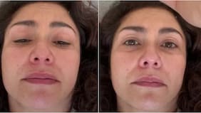 El doloroso accidente que sufrió Tamara Acosta en su casa: compartió un video con las lesiones