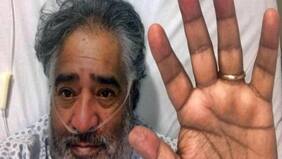 "No tengo fecha de vencimiento": "Yogurt de Mora" le ganó la batalla al coronavirus