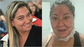 “Tengo la intención de entrar nuevamente…”: Denisse Campos explicó el motivo de sus intervenciones estéticas