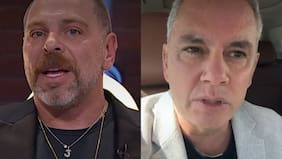 Famosos chilenos que se han sumado a la tendencia del injerto capilar: Viñuela y Neme en la lista