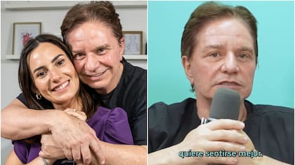 “No es que me molestara mi cara”: esposo de Rosario Bravo habló sobre su drástica cirugía en el rostro