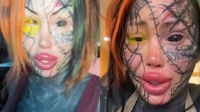 Influencer casi pierde la visión de un ojo tras someterse a inusual procedimiento