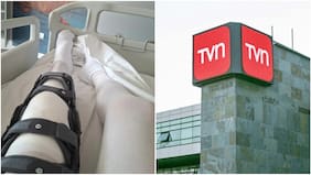 “Quedé con un tajo bien grande”: Periodista de TVN reveló detalles del accidente por el que debió ser operado de urgencia