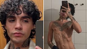 Leo Méndez Jr. muestra su cambio físico tras recuperarse de la anorexia: “Un tiempo toqué fondo”