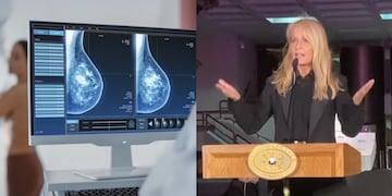 Fundación de Cecilia Bolocco ofrece mamografías gratuitas: entérate cómo acceder