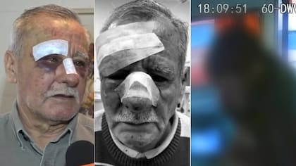 Identifican a estudiante que golpeó sin piedad a chofer de micro: revelan causa de la furia y su insólita versión