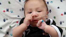 Pequeño de cinco meses necesita el remedio más caro del mundo: sufre delicada enfermedad