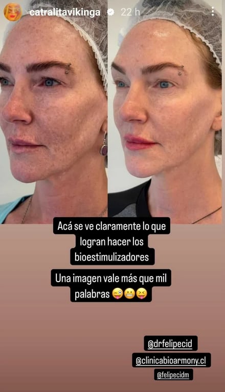 Catalina Pulido Instagram