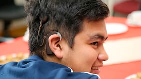 La increíble historia del joven que recuperó la audición tras 10 años