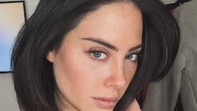 “Esto no me parece sano” y “Ojalá puedas recibir ayuda”: La foto de Ignacia Michelson que generó rechazo de parte de sus seguidores