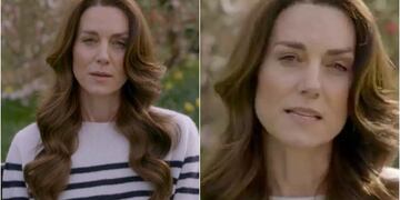 Revelan supuestos detalles inéditos de la operación de Kate Middleton