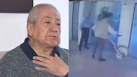 Imágenes fuertes: conserje que frenó a ladrón de bicicleta fue víctima de brutal golpiza y lo terminaron despidiendo