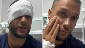 Fabio Agostini envió mensaje a compañeros tras sufrir accidente en Palabra de Honor: reveló detalles sobre su estado de salud