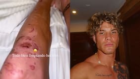 “Limpiando heridas”: Raimundo Cerda actualiza sobre su estado de salud