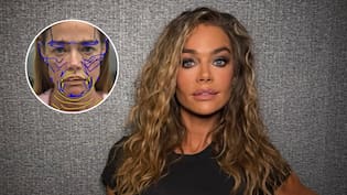 Denise Richards sorprendió con radical transformación tras someterse a cirugía estética: mostró su antes y después