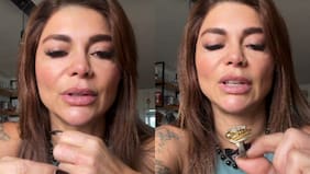 “Estaba muy asustada”: la angustia de Antonella Ríos luego de que se le atorara un anillo en el dedo