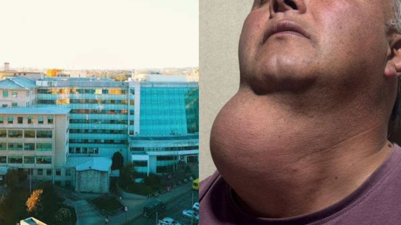 Tiene bulto en el cuello: Hospital Regional de Temuco tomó caso de carpintero que espera más de 15 años por operación