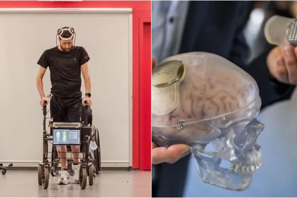 Crean dispositivo cerebral entrenado con inteligencia artificial que permitió a hombre tetrapléjico volver a caminar